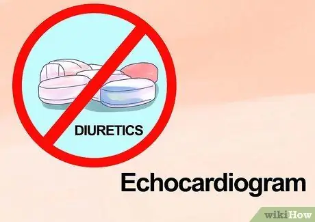 Interpréter les échocardiogrammes Étape 5