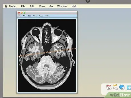 Lees 'n MRI Stap 10