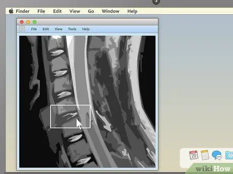 Lees 'n MRI Stap 11