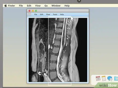 Lees 'n MRI Stap 12