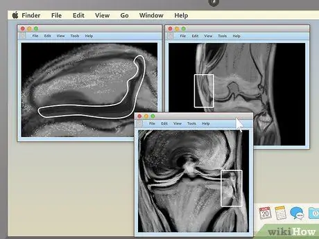 Lees 'n MRI Stap 14