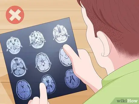 Baca MRI Langkah 15