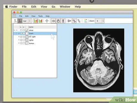 Nyeem MRI Kauj Ruam 5