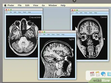 Pročitajte MRI korak 6