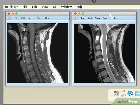 Lugege MRI 7. sammu