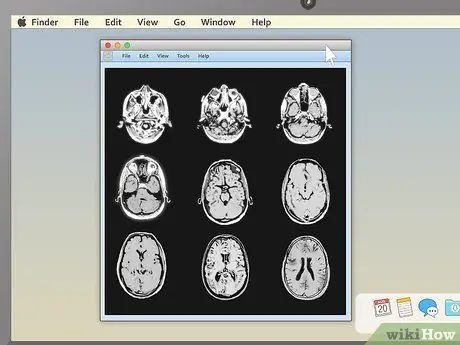 Olvassa el az MRI 8. lépését