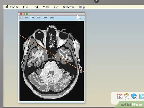 อ่าน MRI ขั้นตอนที่ 9