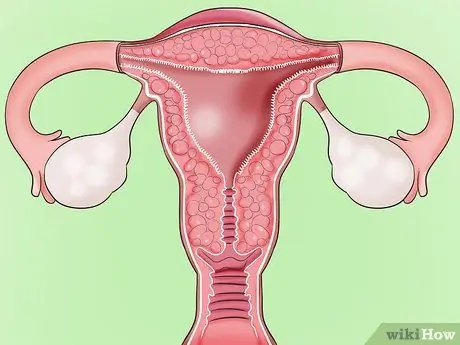 Hacer frente al vaginismo Paso 11