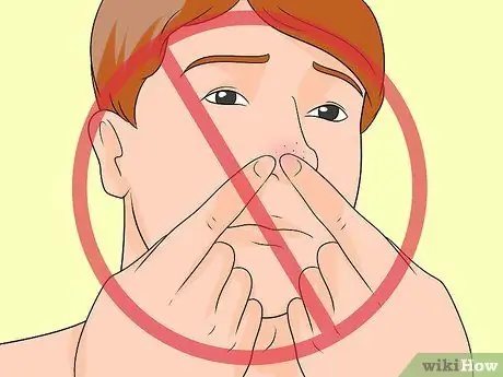 Mencegah Blackheads Langkah 9