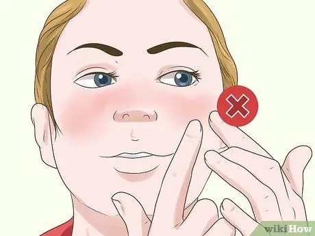 Reduce the Redness of Sunburn Step 16