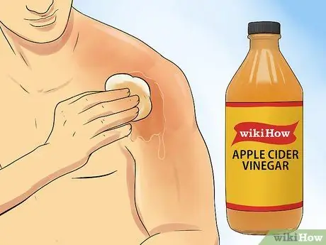 Reduce the Redness of Sunburn Step 5