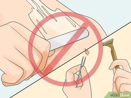 Remove an Ingrown Hair Under the Skin Step 9