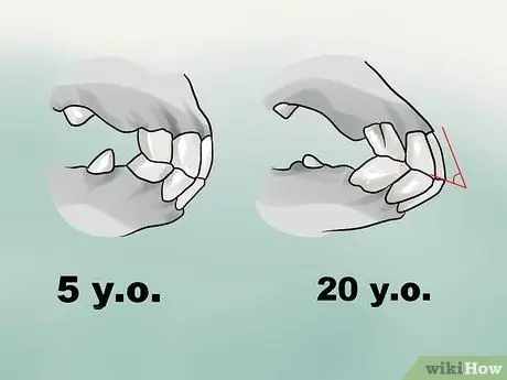 Déterminer l'âge d'un cheval par ses dents Étape 18