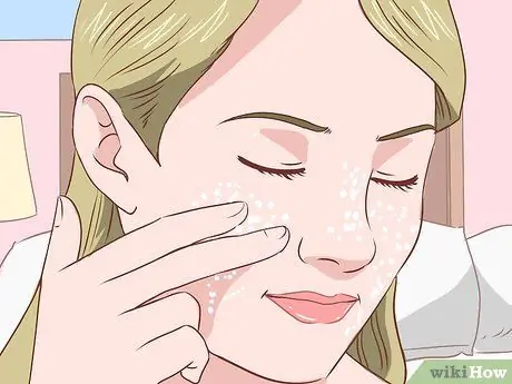 Get Rid of Acne Without Using Medication Step 14