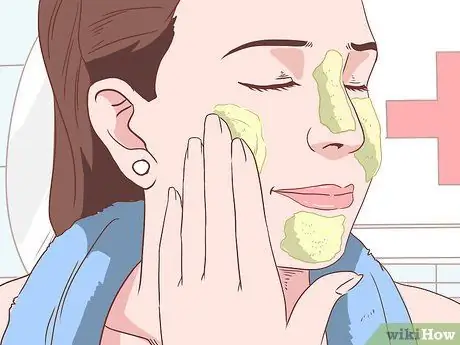 Get Rid of Acne Without Using Medication Step 20