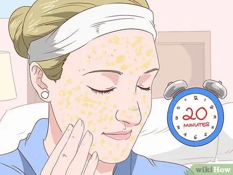 Get Rid of Acne Without Using Medication Step 23