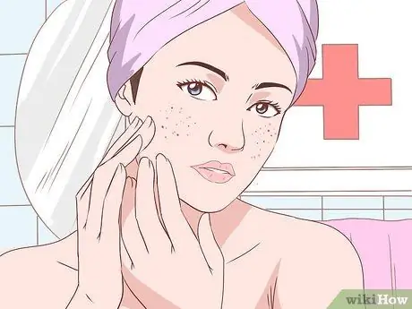 Get Rid of Acne Without Using Medication Step 35