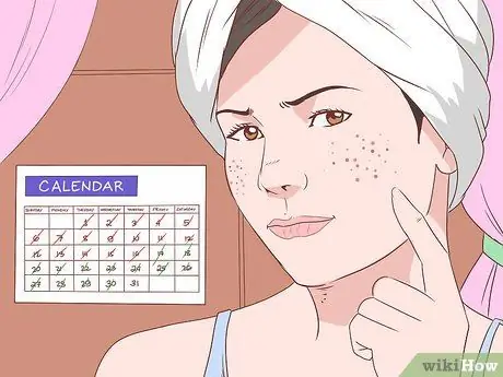 Get Rid of Acne Without Using Medication Step 36